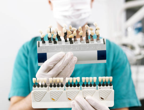 a dentist holding dental veneers in different shades of teeth color