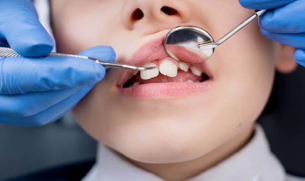 a dentist examining a child's teeth