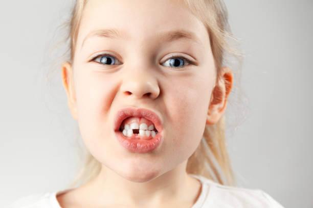 a child with her missing teeth