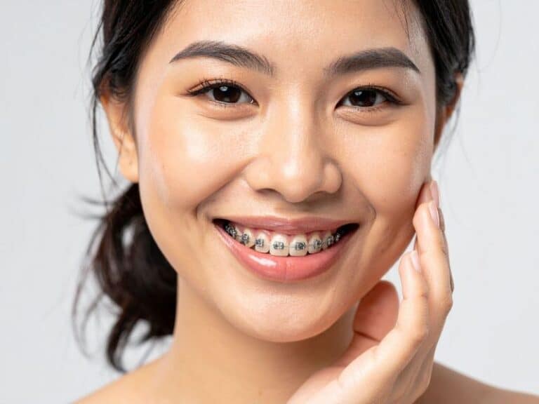 Close-up of ceramic adult braces at our Manhattan orthodontic practice
