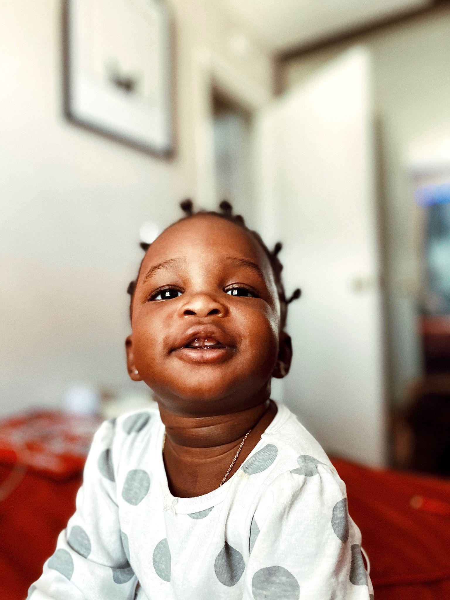 photo of a toddler sitting while showing it's emerging two front teeth