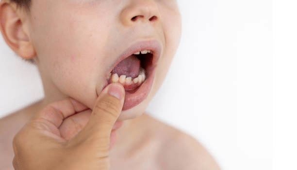 a close-up shot of a baby's mouth showing the teeth